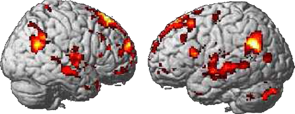 The areas of the brain that light up when viewing your own children or your own brands, different from other images.