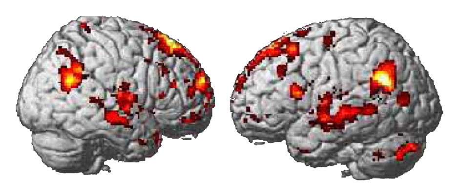 The areas of the brain that light up when viewing your own children or your own brands, different from other images.